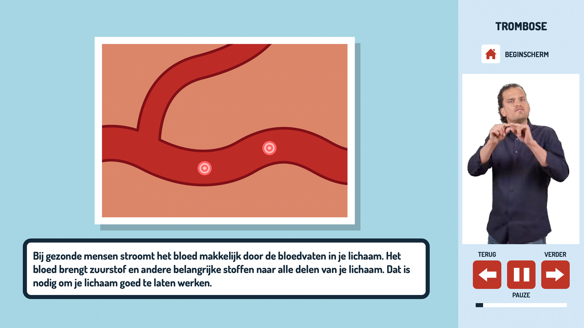 Uitleg over trombose in gebarentaal.